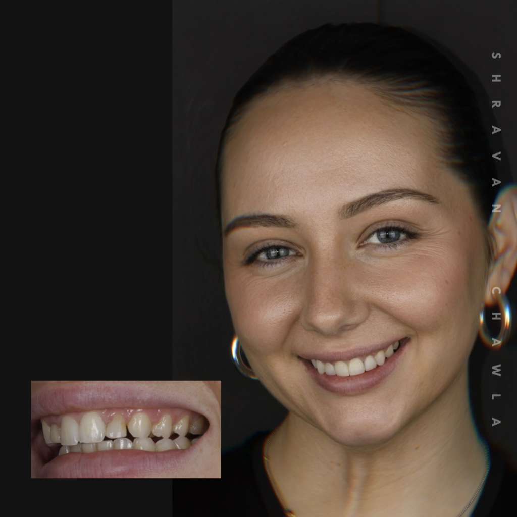 Cosmetic Dentistry