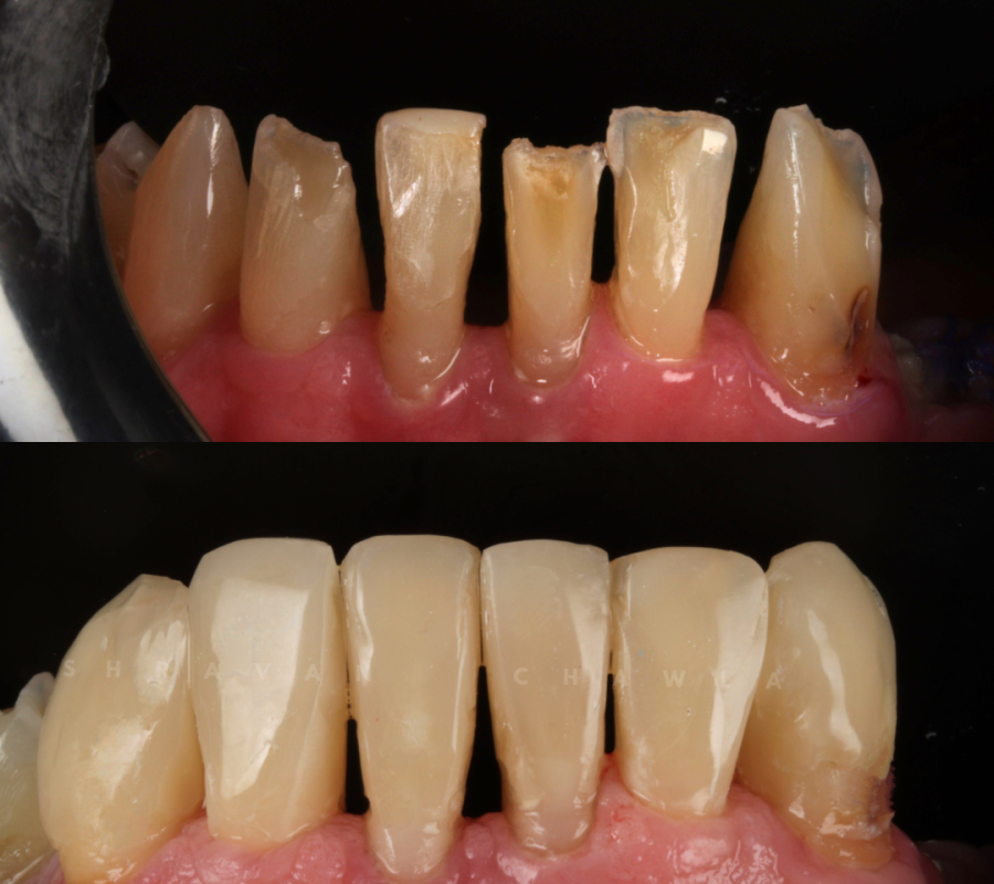 Cosmetic Dentistry (3)