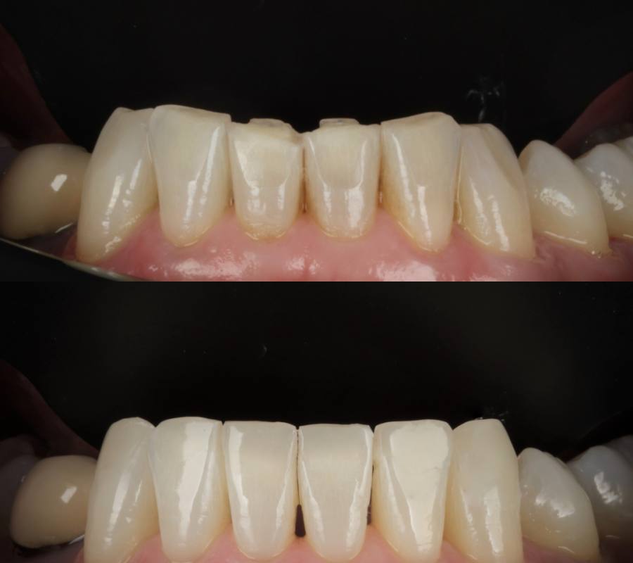 Cosmetic Dentistry (6)