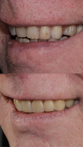 Cosmetic Dentistry London