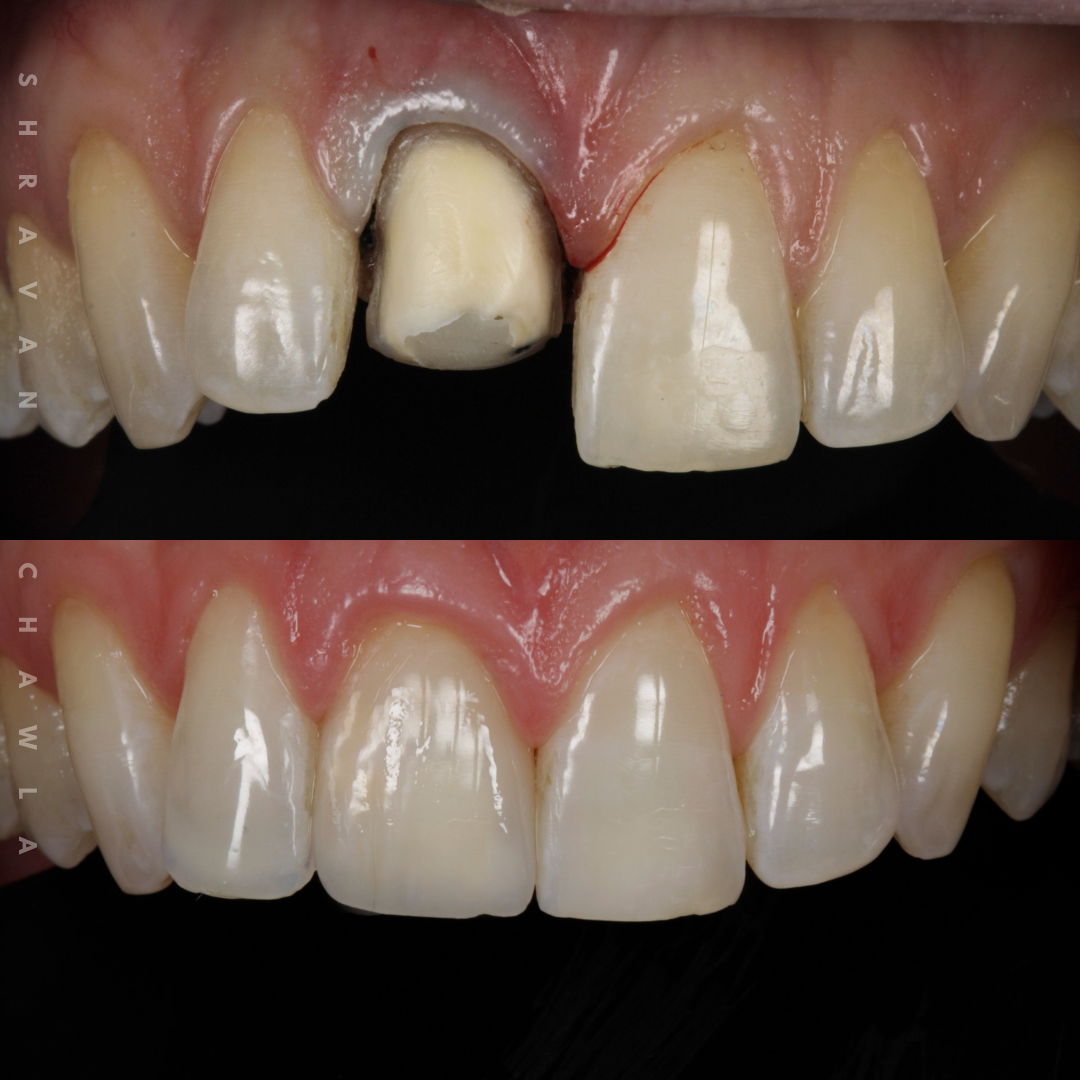 cosmetic dentistry