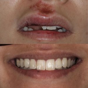 smile makeover near me