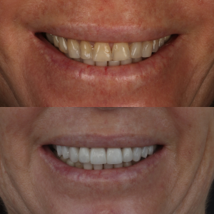 Looking For A Smile Makeover 