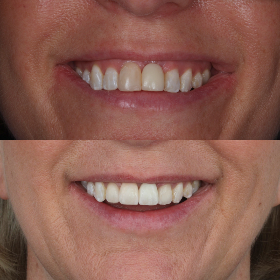 cosmetic dentistry