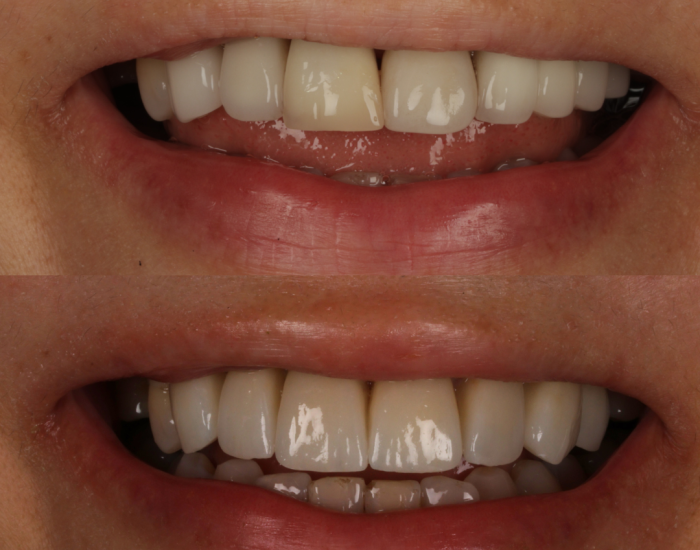 Cosmetic Dentistry Clapham