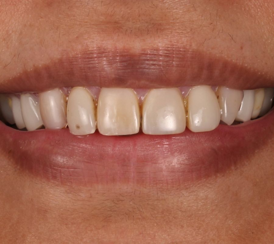 Cosmetic Dentistry Teddington