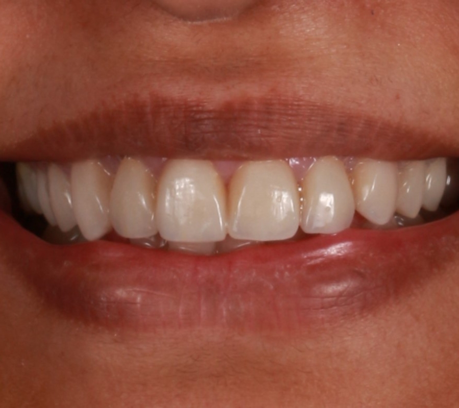 Cosmetic Dentistry