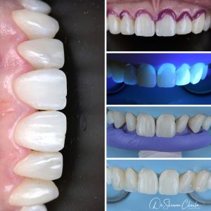 Cosmetic Dentist Near Me