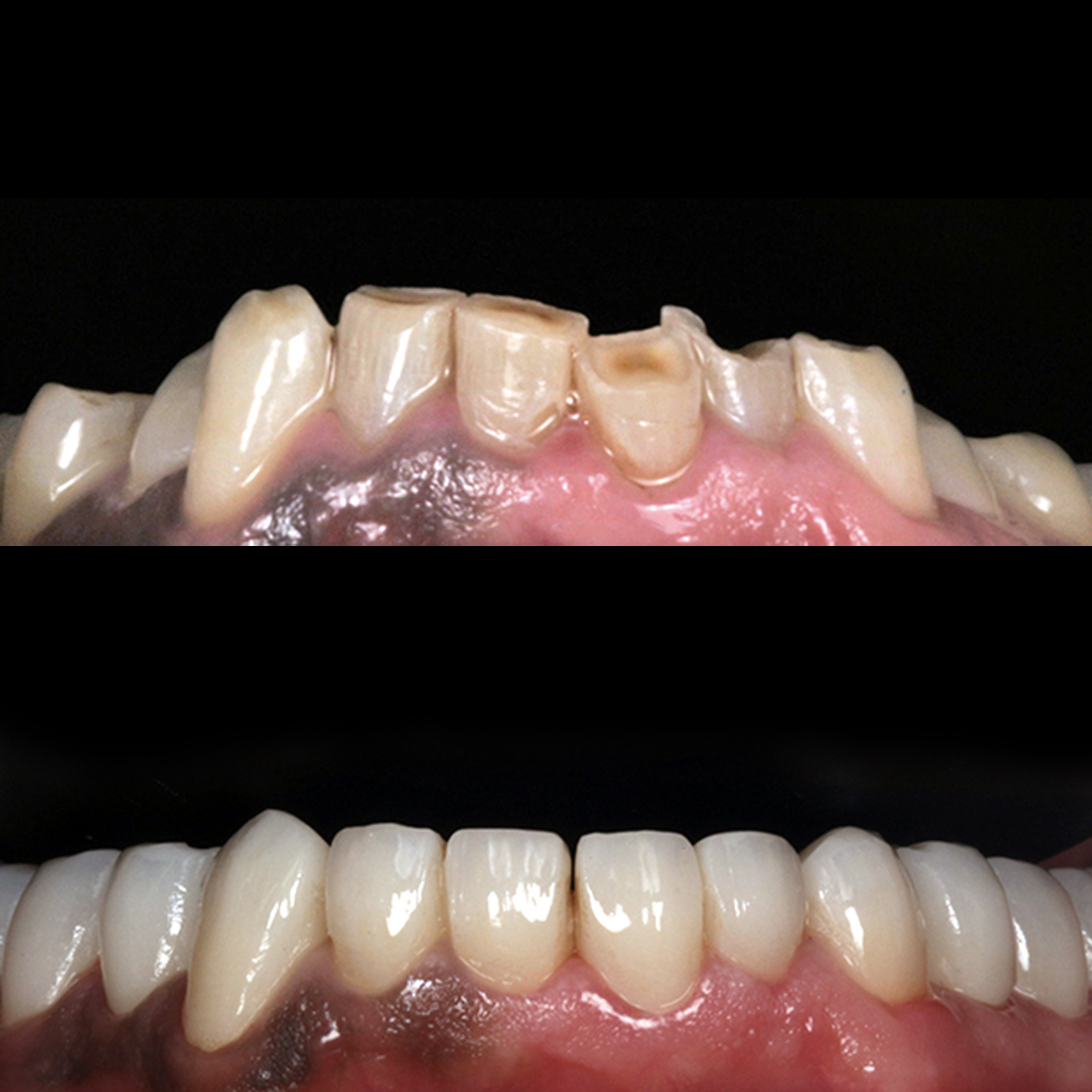 Teeth Repair